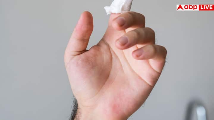 साबुत अनाज, दालें, पोर्क और नट्स विटामिन B1 के अच्छे स्रोत हैं. अगर हाथ कांपने की समस्या लगातार बनी रहे तो ब्लड टेस्ट करवाकर सही कारण जानना और डाइट या सप्लीमेंट्स से सुधार करना बेहद जरूरी है.