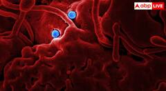 ਮਿਲ ਗਿਆ ਕੈਂਸਰ ਦਾ ਇਲਾਜ! ਟਿਊਮਰ ਨੂੰ ਸਿੱਧਾ ਖ਼ਤਮ ਕਰੇਗੀ ਆਹ ਥੈਰੇਪੀ, ਨਹੀਂ ਪਵੇਗੀ ਇਮਿਊਨ ਸਿਸਟਮ ਦੀ ਲੋੜ