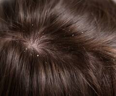 चेहरे पर ही नहीं बालों में भी लगा सकते हैं ग्लिसरीन, इ 7 परेशानियों से मिलेगा छुटकारा