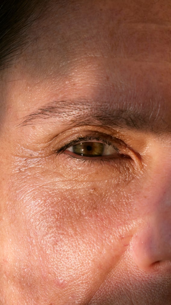 30 வயதில் சுருக்கங்களா? - சரும பாதுகாப்பு டிப்ஸ்!