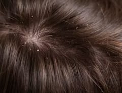 ਚਿਹਰੇ ‘ਤੇ ਨਹੀਂ ਵਾਲਾਂ ‘ਤੇ ਵੀ ਲਾ ਸਕਦੇ ਗਲਿਸਰੀਨ, ਇਨ੍ਹਾਂ ਪਰੇਸ਼ਾਨੀਆਂ ਤੋਂ ਮਿਲੇਗਾ ਛੁਟਕਾਰਾ