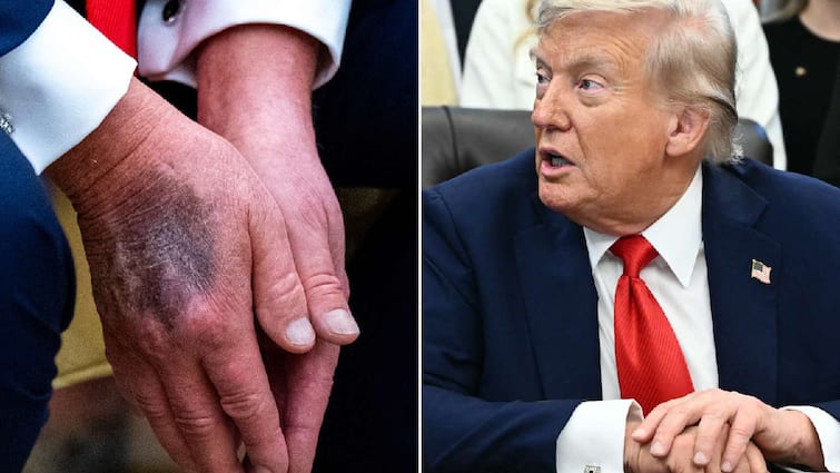 <div>'Trump Is Dead' Goes Viral: Health Rumours, Vance's Remark, Simpsons ‘Prediction’ Fuel Social Media Frenzy</div>