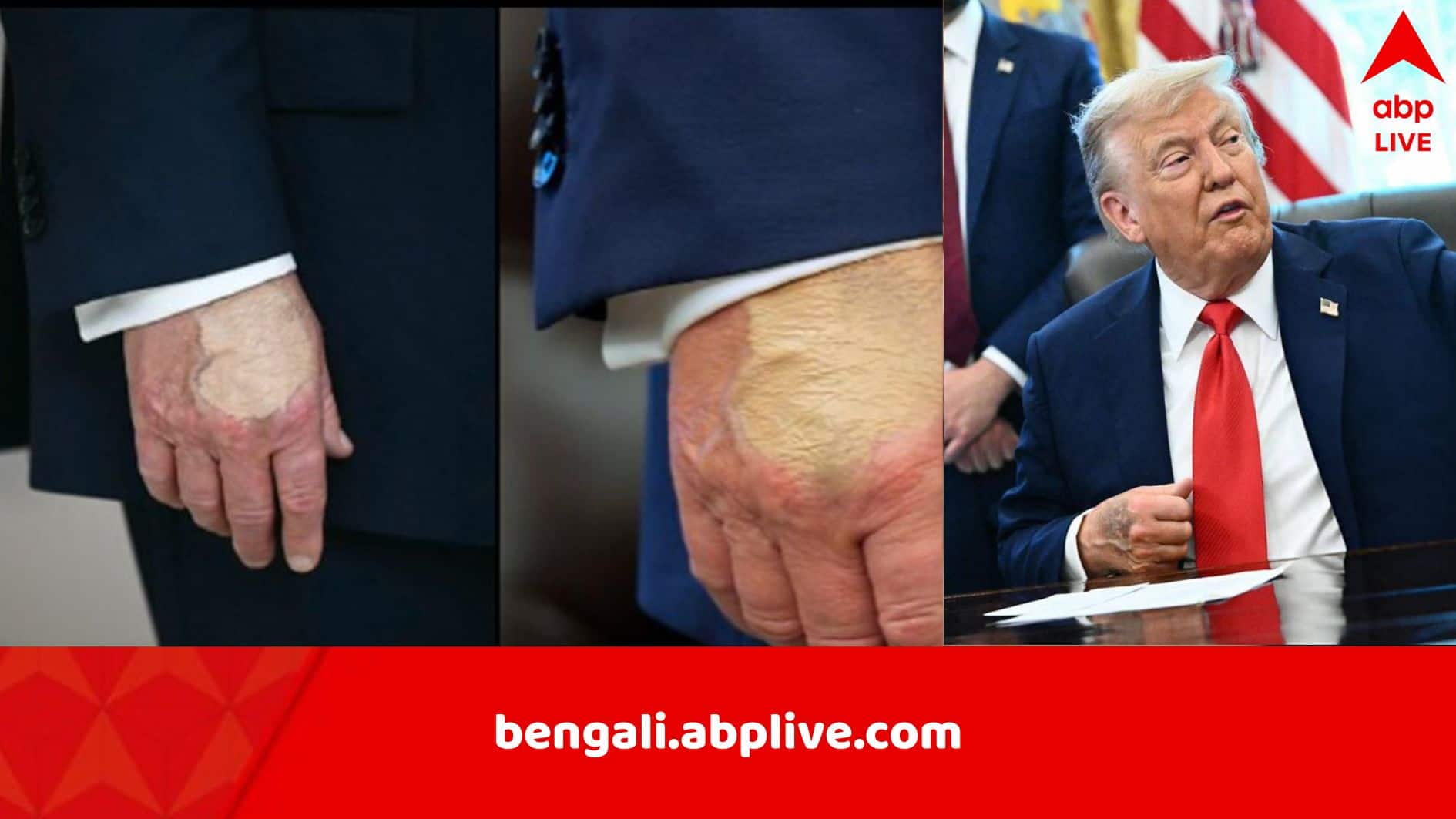 Donald Trump News: অসুস্থতা লুকোতে মেকআপ? ট্রাম্পের স্বাস্থ্য নিয়ে বাড়ছে উদ্বেগ, দায়িত্ব নিতে রাজি…