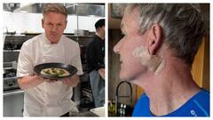 Gordon Ramsay Reveals Skin Cancer Diagnosis, Warns Fans To Use Sunscreen