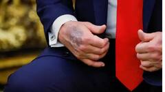 Trump is Dead सोशल मिडियावर व्हायरल, उजव्या हाताच्या स्कीनवरील काळे डाग व्हायरल, कोणता आजार जडला? उपराष्ट्रपतींच्या वक्तव्यानेही भूवया उंचावल्या