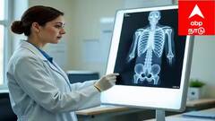 சென்னை மாநகராட்சி வேலை! 306 காலிப்பணியிடங்கள்: 8-ம் வகுப்பு படித்தவர்களும் விண்ணப்பிக்கலாம்