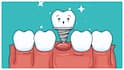 Japan Dental Regrowth: దంతాలు ఊడిన ప్రతిసారి పెరుగుతాయి! సరికొత్త విప్లవం తీసుకొచ్చిన జపాన్ శాస్త్రవేత్తలు 