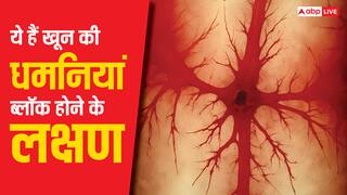 ये 10 लक्षण दिखें तो समझ जाएं खून की धमनियां हो रहीं ब्लॉक, तुरंत भागें डॉक्टर के पास