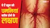ये 10 लक्षण दिखें तो समझ जाएं खून की धमनियां हो रहीं ब्लॉक, तुरंत भागें डॉक्टर के पास