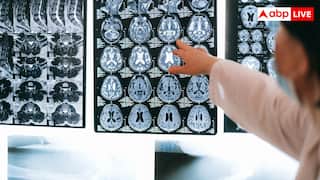 ब्रेन स्ट्रोक के मरीजों के लिए क्या होता है गोल्डन पीरियड, कब तक बच सकती है जान?