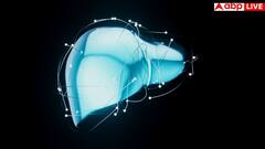 लिवर ट्रांसप्लांट में कितना आता है खर्चा, डोनर के लिए क्या बातें जरूरी, जान लीजिए सबकुछ