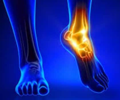 टेंडोनाइटिस: बार-बार एक जैसी गतिविधि करने या अचानक चोट लगने में सूजन हो जाती है. इससे कलाई में तेज दर्द और हिलाने-डुलाने में दिक्कत होती है.