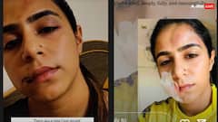 चेहरे पर पंच और पेट पर मारी लात... मलयालम एक्ट्रेस ने एक्स बॉयफ्रेंड पर लगाए मारपीट के आरोप