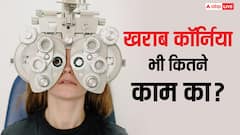 खराब कॉर्निया ट्रांसप्लांट कराकर भी देख सकेंगे नेत्रहीन, डॉक्टरों ने ढूंढ निकाला कमाल का फॉर्म्युला
