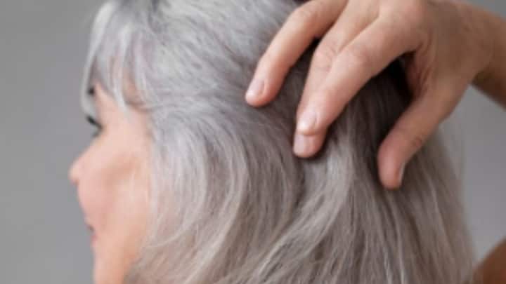 Guo জানিয়েছেন, অনিয়মিত জীবনযাপনের জন্যই অল্প বয়সে চুলে পাক ধরে তাঁর। হতাশা গ্রাস করছে তাঁকে, সেই সময়ই বিশেষ চিকিৎসাপদ্ধতির কথা জানতে পারেন, যার মাধ্যমে পাকা চুল আবারও আগের রং ফিরে পাবে।