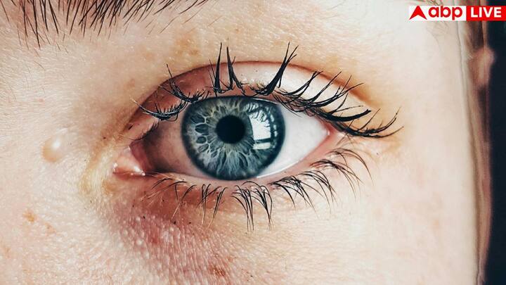 एनीमिया के मरीजों को अक्सर चक्कर आना, थकान, दिल की धड़कन तेज होना और सांस फूलने जैसी समस्याएं भी होती हैं. खासकर महिलाएं और बच्चे इस बीमारी की चपेट में जल्दी आते हैं.