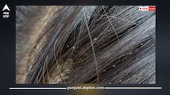 ਧਿਆਨ ਦਿਓ! ਬਾਰਿਸ਼ ਦੇ ਮੌਸਮ ਕਰਕੇ ਕਿਤੇ ਬੱਚਿਆਂ ਦੇ ਸਿਰ 'ਚ ਪੈ ਤਾਂ ਨਹੀਂ ਗਈਆਂ ਜੂਆਂ? ਇਹ ਨੁਸਖਿਆਂ ਨਾਲ 1 ਹਫ਼ਤੇ 'ਚ ਕਰੋ ਦੂਰ