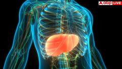 फैटी लिवर के इन 3 मिथ पर आंखें बंद करके यकीन कर लेते हैं लोग, एम्स और हॉवर्ड के डॉक्टरों से जान लें सच्चाई