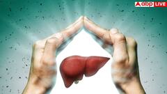 फैटी लिवर के इन 3 मिथ पर आंखें बंद करके यकीन कर लेते हैं लोग, एम्स और हॉवर्ड के डॉक्टरों से जान लें सच्चाई