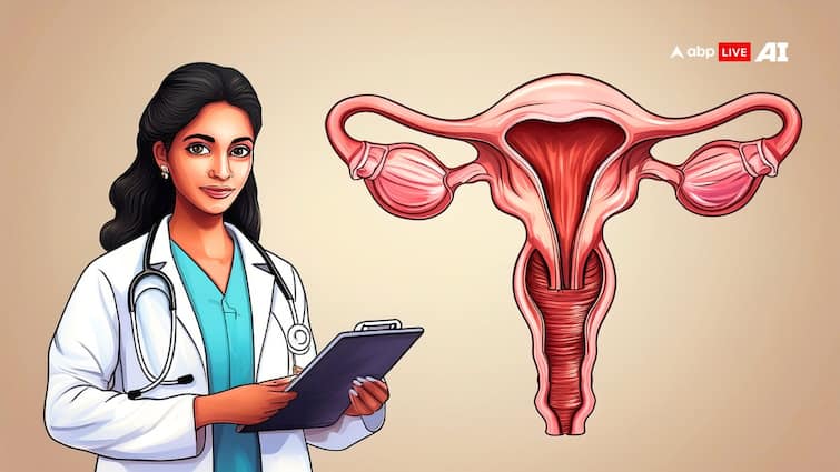 When Endometriosis Turns Deadly: Understanding Its Link To Ovarian Cancer