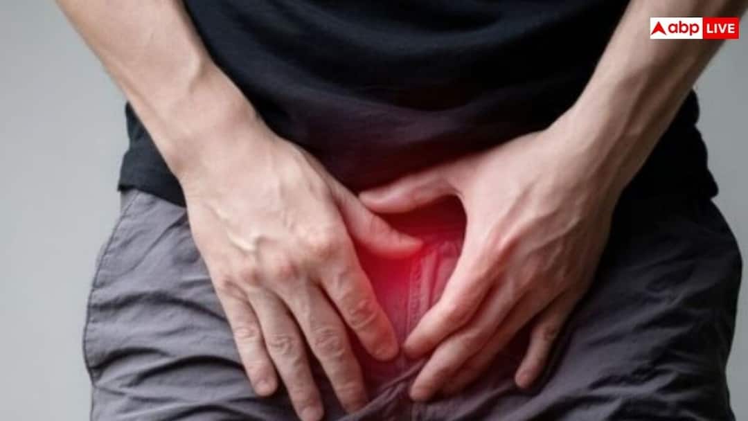 difference between hydrocele and hernia symptoms preventions एक जैसी दिखने वाली दो बीमारियां, हाइड्रोसील और हर्निया में क्या है अंतर...कैसे करें इसकी सही पहचान