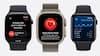 Apple Watch Series: மினி டாக்டர் - ஹைபர் டென்ஷன், நல்லா தூங்குனீங்களா? காட்டிக் கொடுக்கும் ஆப்பிள் வாட்ச் சீரிஸ் 11