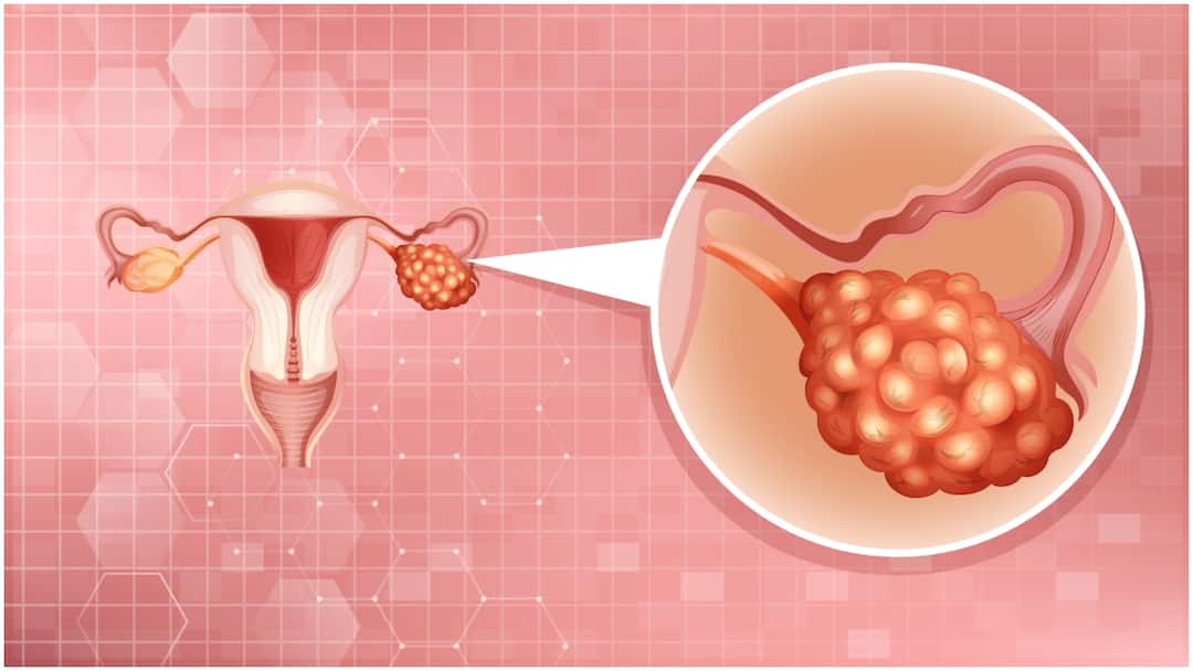 புற்றுநோய்க்கு இனி மரண பயம் இல்லை! mRNA தொழில்நுட்பம் தரும் நம்பிக்கை: மருத்துவர் விளக்கம்!