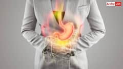 Health Tips: एसडिटी ठीक करने का आसान तरीका, आज से ही डाइट में शामिल करें ये चीजें