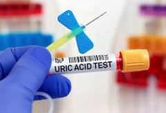 શરીરમાં યુરિક એસિડ વધી જાય તો જોવા મળે છે આ લક્ષણો, ઝડપથી તેને ઓળખો અને કરો સારવાર