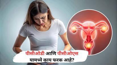 बर्याचदा पीसीओडी आणि पीसीओएस यामध्ये गोंधळ होतो, पण प्रत्यक्षात हे दोन्ही वेगळे विकार आहेत.