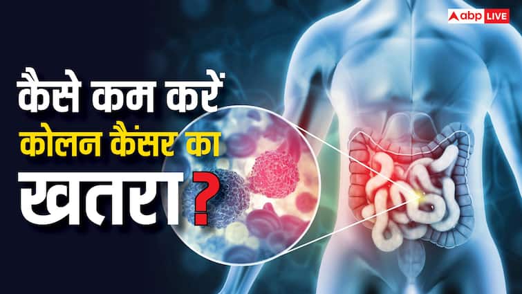 Colon Cancer: ये 7 फूड तुरंत खाना छोड़ दें तो कम हो जाएगा कोलन कैंसर होने का खतरा, यूथ में ज्यादा बढ़ रहा खतरा
