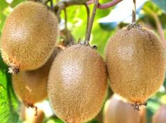 કીવી હૃદયના દર્દીઓ માટે ખૂબ જ ફાયદાકારક, જાણો અન્ય ફાયદાઓ