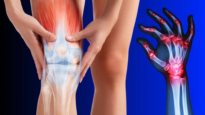 चुकीच्या झोपेच्या स्थितीमुळे शरीरातील संधिवात वाढू शकतो. पाठीचा व मुळ भाग अधिक दुखतो.