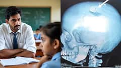 అల్లరి చేస్తోందని విద్యార్థిని తల పగలగొట్టిన టీచర్‌.. చిత్తూరులో దారుణం