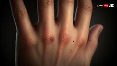 हाथों-पैरों में दिखें ये लक्षण तो समझ जाएं डैमेज हो गईं नर्व्स, जानें इसे पहचानने का तरीका