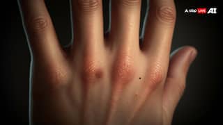 Nervous System: हाथों-पैरों में दिखें ये लक्षण तो समझ जाएं डैमेज हो गईं नर्व्स, जानें इसे पहचानने का तरीका