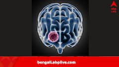 নদী-পুকুর, সুইমিং পুলেও বিপদ, নাকে জল ঢুকলেই…কেরলে মস্তিষ্কখেকো অ্যামিবার কবলে ৬৭, মৃত ১৮