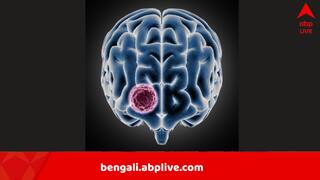 Amoebic Meningoencephalitis: নদী-পুকুর, সুইমিং পুলেও বিপদ, নাকে জল ঢুকলেই…কেরলে মস্তিষ্কখেকো অ্যামিবার কবলে ৬৭, মৃত ১৮