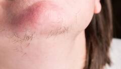 Symptoms of PCOS: पीसीओएस होने पर दिखते हैं ये लक्षण, कहीं आपको तो नहीं होती ये दिक्कत