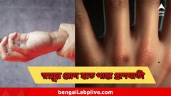 স্নায়ুর অসুখ আপনাকে করতে পারে অথর্ব, হতে পারে অকাল মৃত্যুও, সাবধান হয়ে যান হাত-পায়ের এইসব লক্ষণে