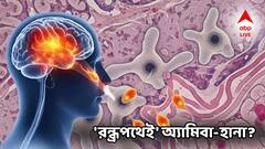 প্রথমে মাথায় এরপর কানে অসহ্য ব্যথা! জীবন ফিরে পেয়ে নরক যন্ত্রণার কথা জানালেন রোগী! এই পেশায় 'ঘিলু খেকো অ্যামিবা'র দাপট বাড়ছে?