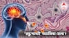 Brain Eating Amoeba: প্রথমে মাথায় এরপর কানে অসহ্য ব্যথা! জীবন ফিরে পেয়ে নরক যন্ত্রণার কথা জানালেন রোগী! এই পেশায় 'ঘিলু খেকো অ্যামিবা'র দাপট বাড়ছে?