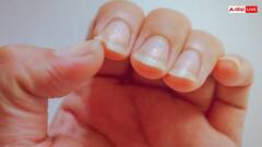 नाखून के ऊपर दिख रहा है ये निशान तो समझ लीजिए इस चीज की हो गई कमी, कई इशारे करते हैं हमारे नाखून