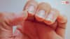 Nail Marks Symptoms: नाखून के ऊपर दिख रहा है ये निशान तो समझ लीजिए इस चीज की हो गई कमी, कई इशारे करते हैं हमारे नाखून