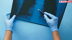 Tuberculosis Diagnosis AI: इस तरह रिकॉर्ड करें अपनी आवाज और AI बता देगा कि आपको टीबी है या नहीं? जानें कैसे काम करेगी यह तकनीक