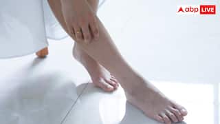 पैरों में जलन की समस्या को न करें नजरअंदाज, हो सकते हैं गंभीर बीमारी का संकेत