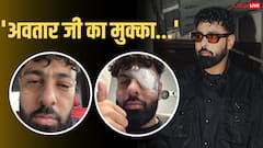 अमेरिका टूर के दौरान बादशाह को लगी चोट, सूजी आंखों के साथ शेयर की तस्वीरें