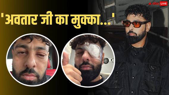 अमेरिका टूर के दौरान बादशाह को लगी चोट, सूजी आंखों के साथ शेयर की तस्वीरें