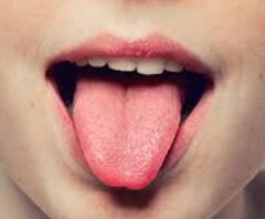 Symptoms of Burning Mouth Syndrome: मुंह की जलन क्यों नहीं होती खत्म? कैसे पहचानें बर्निंग माउथ सिंड्रोम के लक्षण