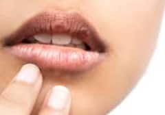 Symptoms of Burning Mouth Syndrome: मुंह की जलन क्यों नहीं होती खत्म? कैसे पहचानें बर्निंग माउथ सिंड्रोम के लक्षण